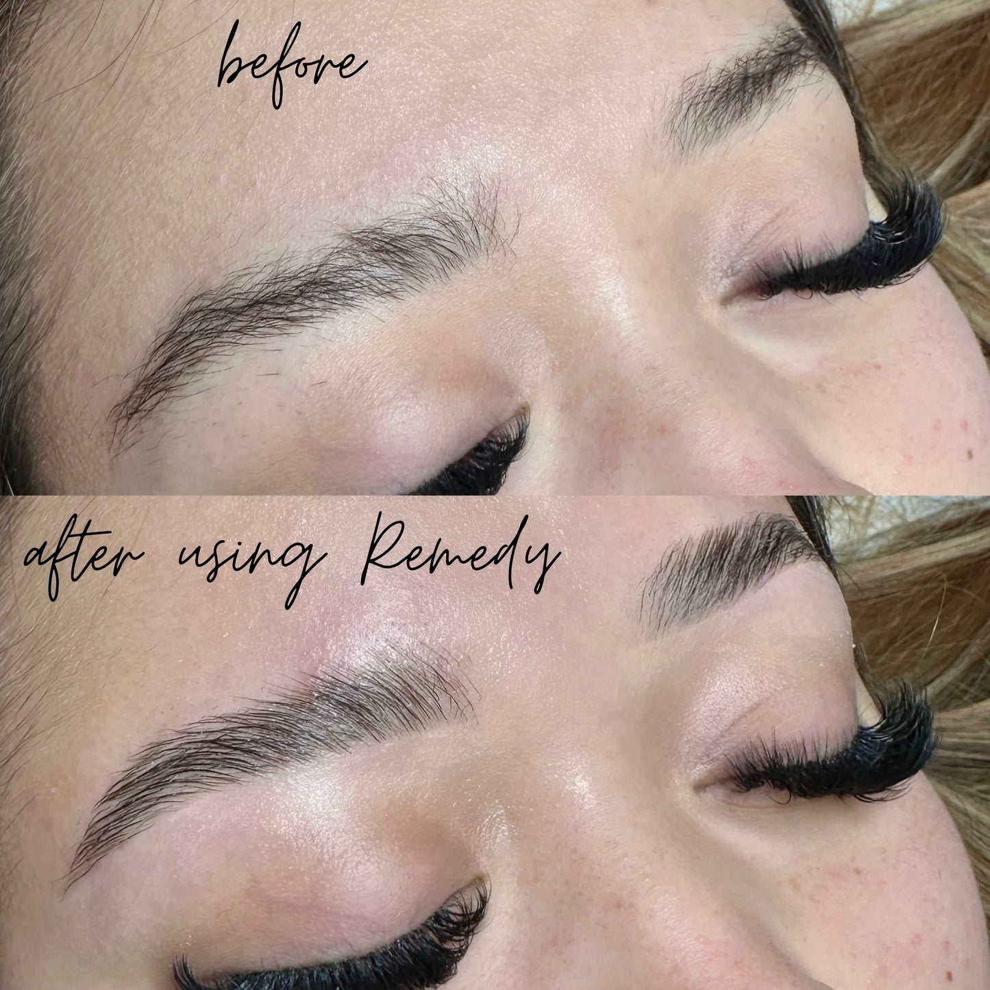 BROW AND LASH REMEDY